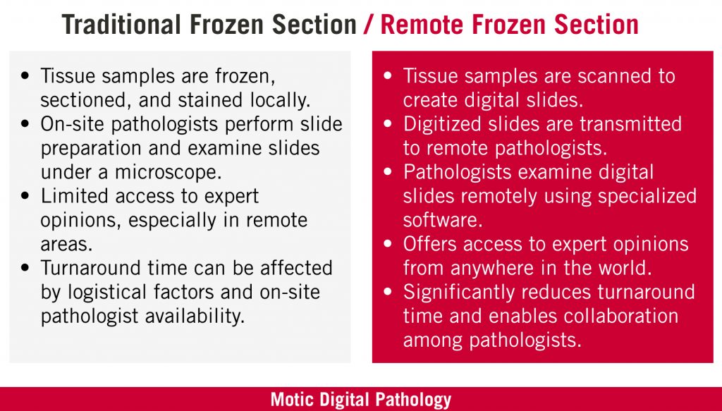 Tradition Frozen Section VS Remote Frozen Section